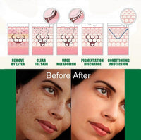 Eelhoe Dark Spot Correcting Glow Serum & Hoygi Niacinamide 10%+TXA 3% Serum