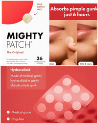 MsGlitz Acne Pimple Patch - Korean Skin Care - Clear - Lab Tested - 36's