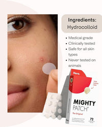 MsGlitz Acne Pimple Patch - Korean Skin Care - Clear - Lab Tested - 36's